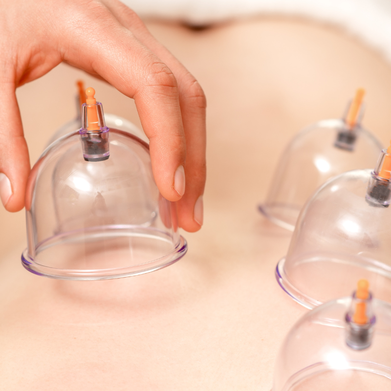 2 cupping menstrie